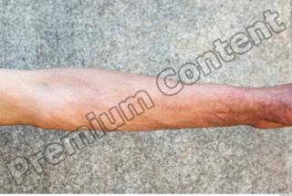 Forearm texture of street references 345 0001